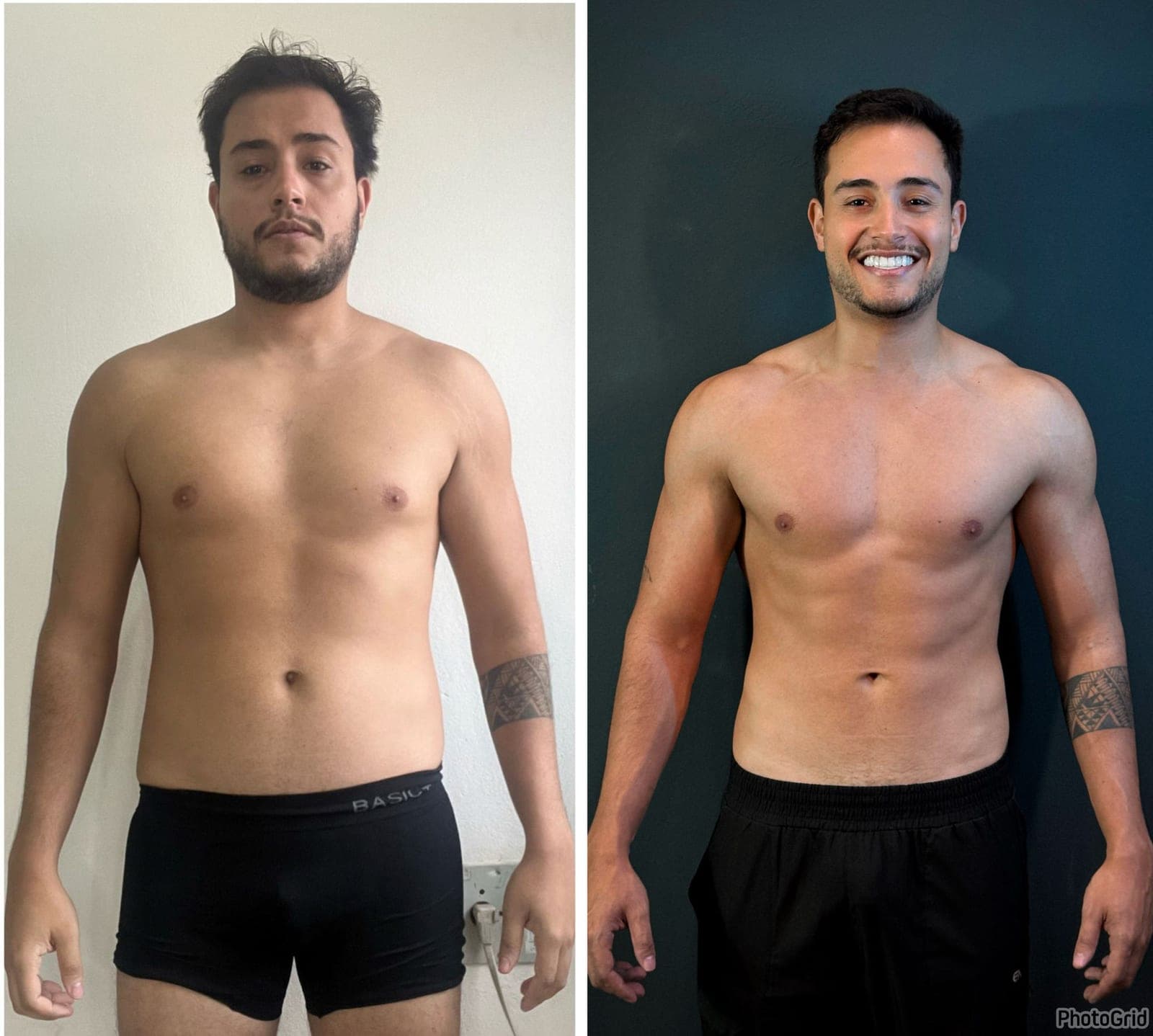 Duas fotos do mesmo paciente, de frente, em dois momentos do acompanhamento nutricional (1 de 9)