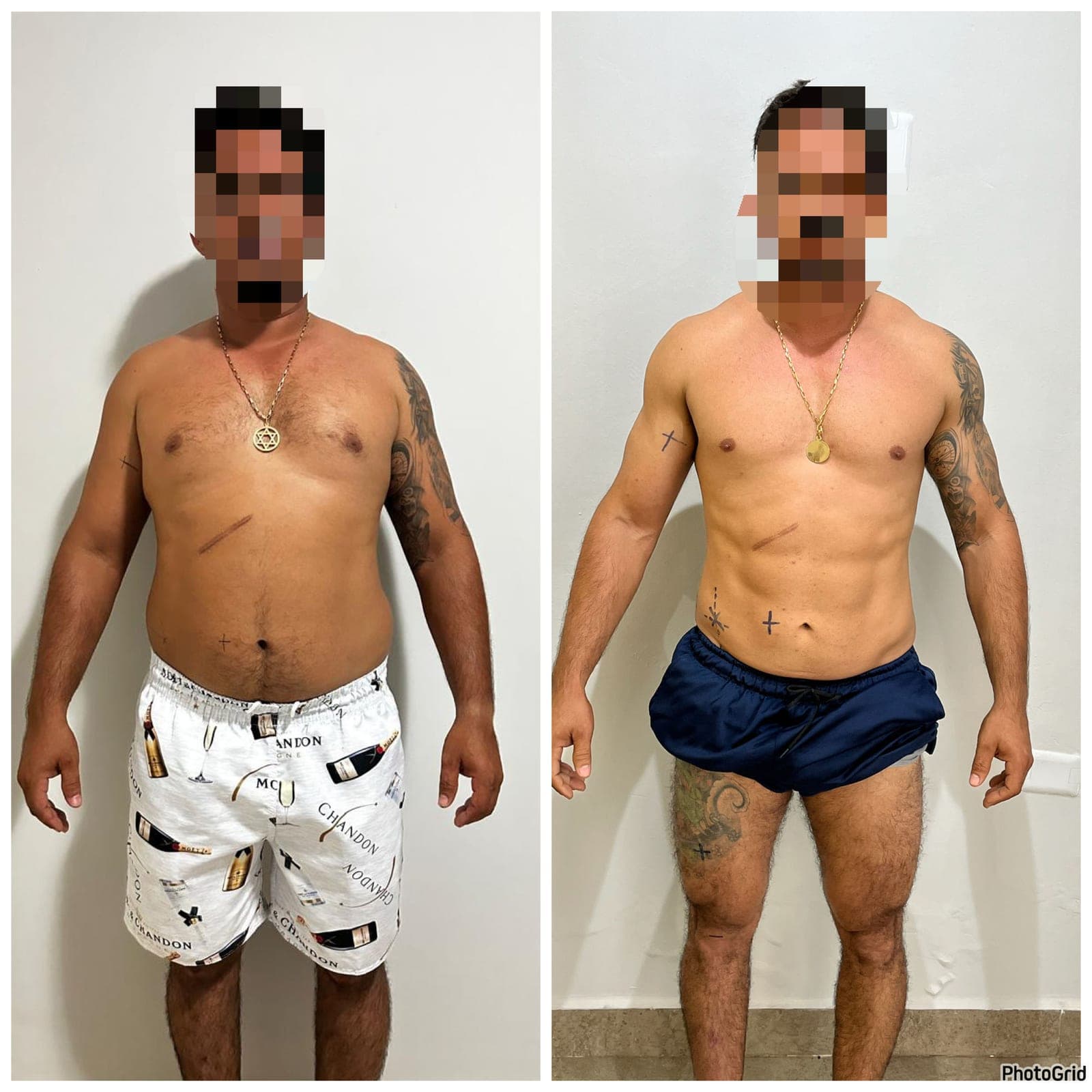 Duas fotos do mesmo paciente, de frente, em dois momentos do acompanhamento nutricional (2 de 9)