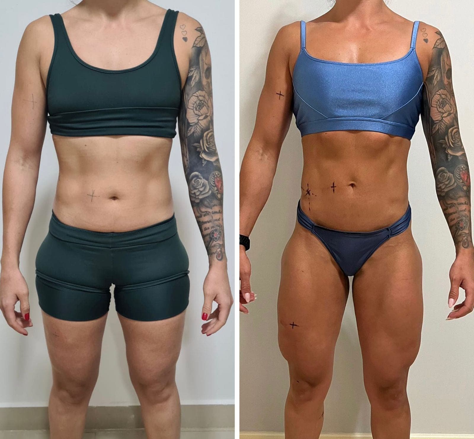 Duas fotos da mesma paciente, de frente, em dois momentos do acompanhamento nutricional (7 de 9)